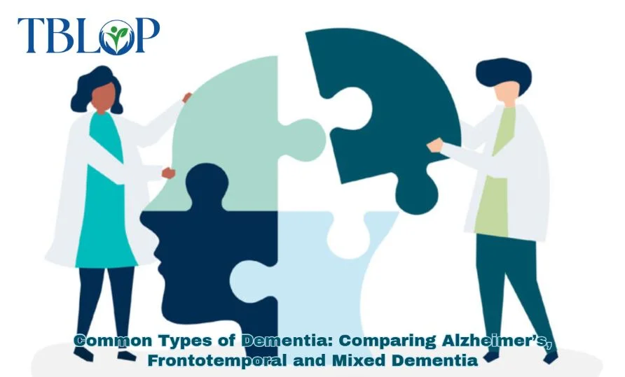 Common Types of Dementia: Comparing Alzheimer’s, Frontotemporal and Mixed Dementia