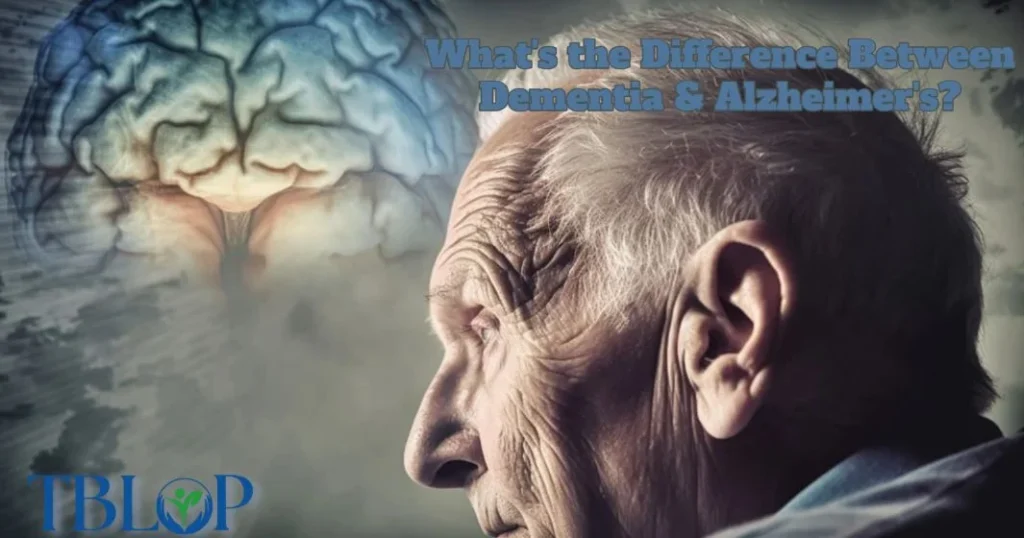 What's the Difference Between Dementia & Alzheimer's?